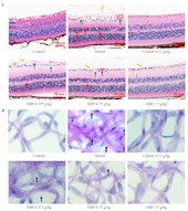 孟憲麗教授團(tuán)隊在Journal of Ethnopharmacology期刊發(fā)表藏藥小檗皮改善糖尿病視網(wǎng)膜疾病新機(jī)制的研究成果